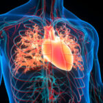 Congestive Heart Failure: Symptoms, Stages, and Modern Treatment Approaches