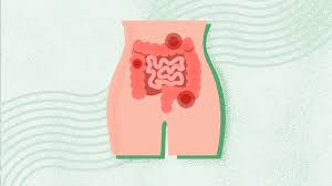 How Constipation Affects Your Daily Life and How to Fix It