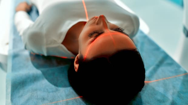 The Evolution of CT Scans in Cancer Imaging