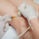 Combating Osteoarthritis with PRP Therapy: A Patient’s Journey