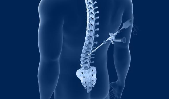 Different Types of Spine Surgery Procedures