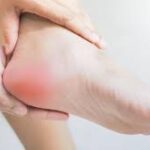 Effective Strategies for Managing Plantar Fasciitis Pain