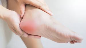 Effective Strategies for Managing Plantar Fasciitis Pain
