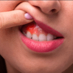 How To Prevent Tooth and Gum Health Issues
