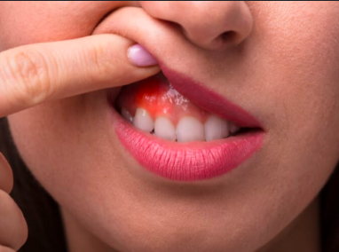 How To Prevent Tooth and Gum Health Issues