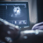How Ultrasound Technology Helps in Monitoring Your Pregnancy Progress