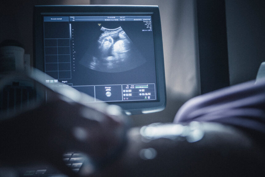 How Ultrasound Technology Helps in Monitoring Your Pregnancy Progress