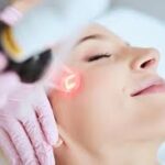 How to Choose Between Chemical Peels and Laser Treatments