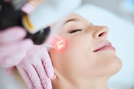 How to Choose Between Chemical Peels and Laser Treatments