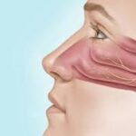 Prevention Tips for Nasal Allergies and Outdoor Activities