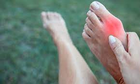 The Connection Between Bunions and Joint Pain in Your Feet