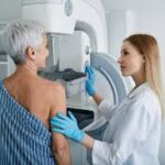 The Impact of Mammograms on Early Detection of Breast Cancer