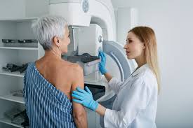 The Impact of Mammograms on Early Detection of Breast Cancer