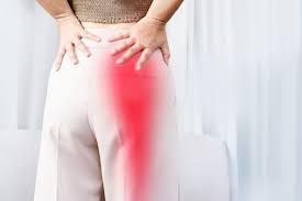 Understanding Sciatica and How to Manage Symptoms
