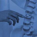 Understanding the Kyphoplasty Procedure for Spine Restoration