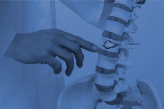 Understanding the Kyphoplasty Procedure for Spine Restoration