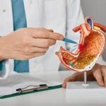 What Do Digestive Disease Specialists Treat?