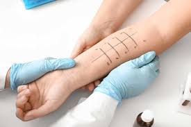 What To Expect From an Allergy Testing Procedure
