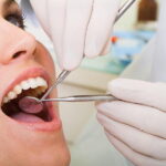 What to Expect During Your First Visit to a Restorative Dentist