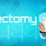 What to Expect During a Vasectomy Procedure: Step-by-Step