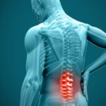 When Is Disc Surgery the Best Option for Your Condition?