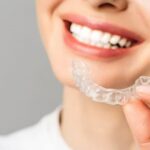 Why More People Are Choosing Invisalign for Straightening Teeth