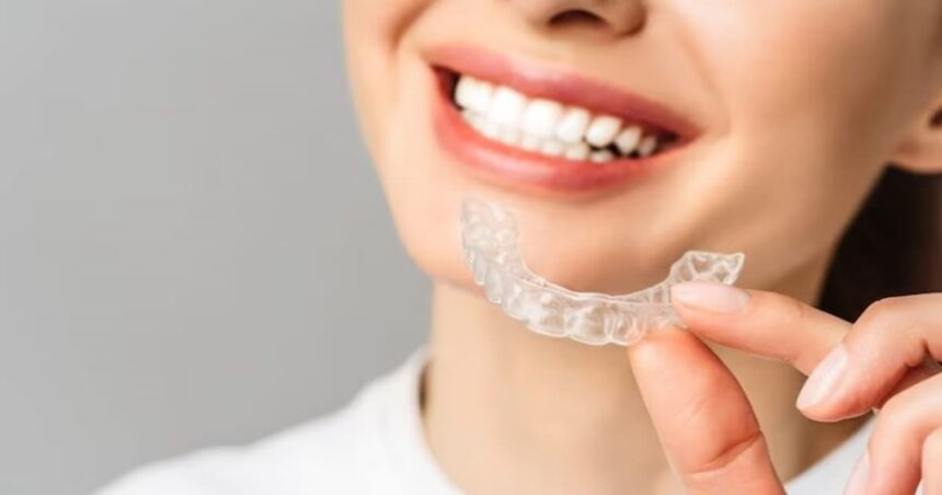 Why More People Are Choosing Invisalign for Straightening Teeth