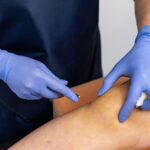 Benefits of PRP Injections