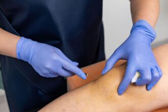 Benefits of PRP Injections