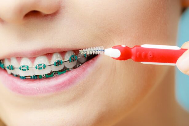 Care for Your Braces