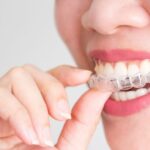 Choosing Invisalign