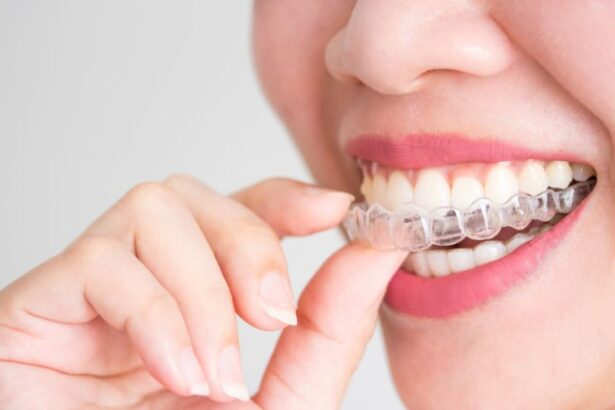 Choosing Invisalign