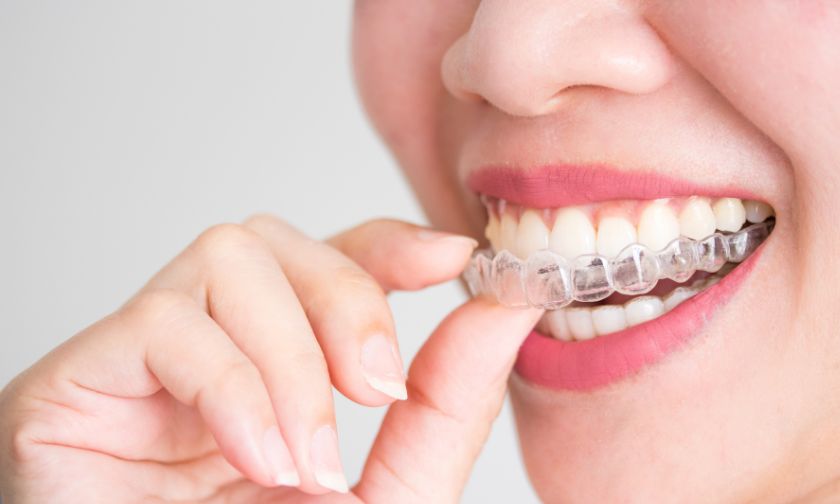 Choosing Invisalign
