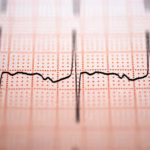 Congestive Heart Failure