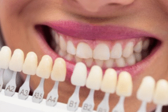 Cosmetic Dental Issues