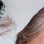 Hormonal Hair Loss