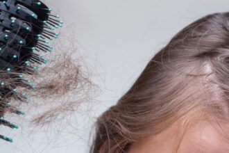 Hormonal Hair Loss