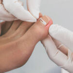 Ingrown Toenail Pain