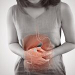 Managing Crohn's Disease Symptoms