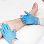 Vein Clinic Consultation