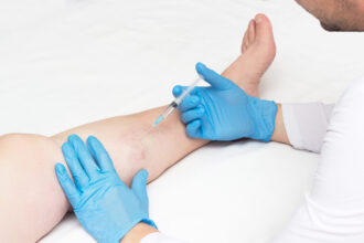 Vein Clinic Consultation