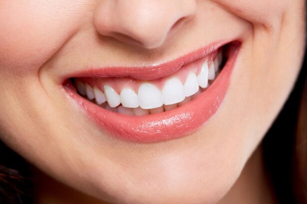 Cosmetic Dentistry for a Perfect Smile