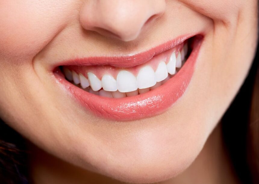 Cosmetic Dentistry for a Perfect Smile