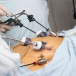 Bariatric Surgeon