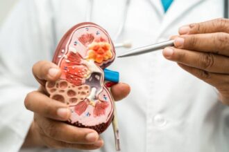 Benefits of Cryoablation for Tumor Treatment