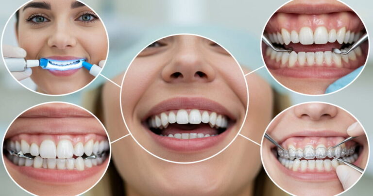 Cosmetic Dentistry Procedures
