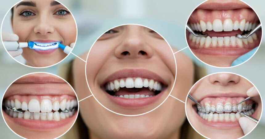 Cosmetic Dentistry Procedures