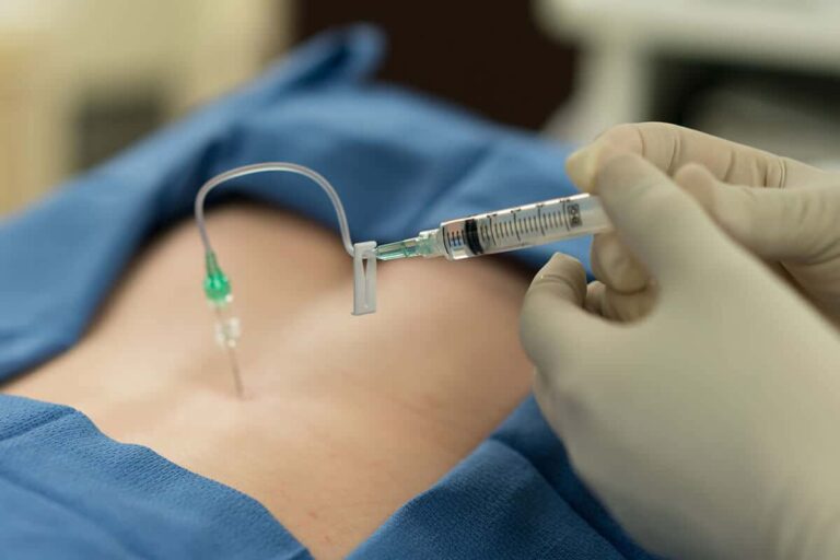 Epidural Injections for Chronic Pain