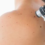 Skin Cancer Screening Appointment