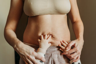 Transforming a Post-pregnancy Body